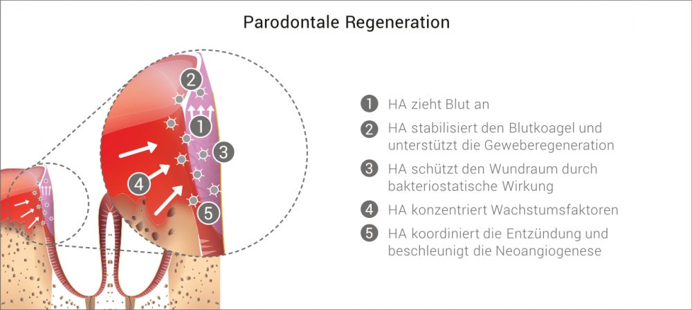 Rezessionsdeckung / Plastisch-Ästhetische Chirurgie