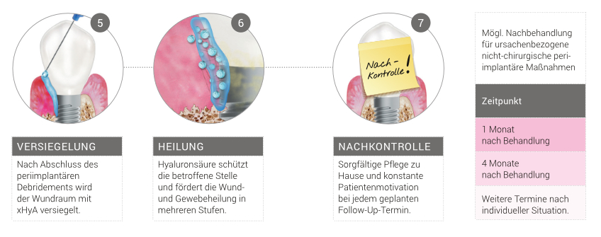 Bild Ablauf Clean & Seal