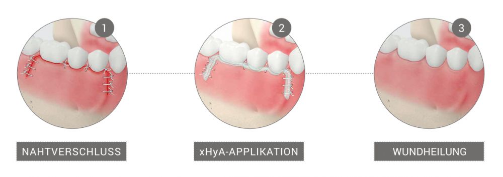Wund- und Gewebeheilung