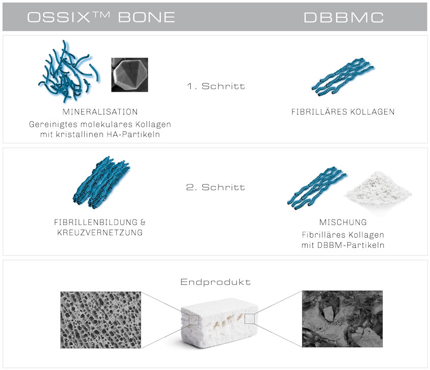 Bild Regedent OSSIX BONE Technologie