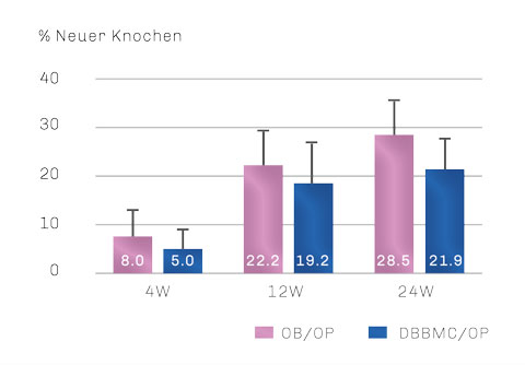Bild Regedent OSSIX BONE Vorteile
