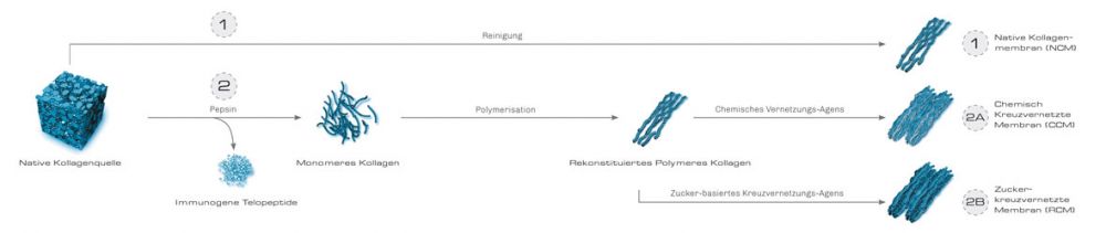 Bild Regedent OSSIX PLUS Technologie