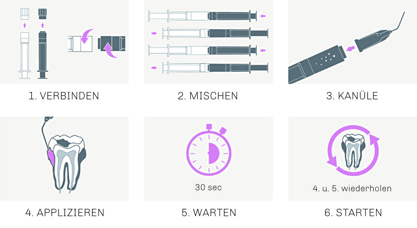 Bild Regedent PERISOLV Produkt Anwendung