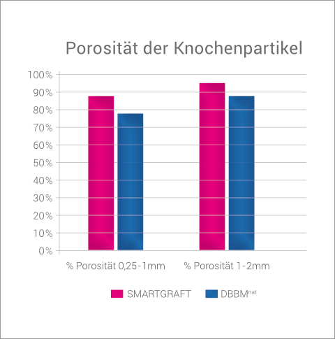 Regedent SMARTGRAFT Produkt Vorteile