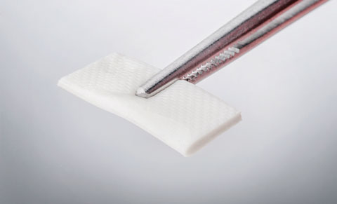 Bild Regedent OSSIX VOLUMAX Indikationen