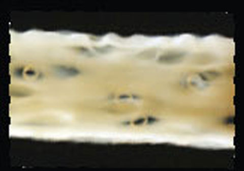 Bild Regedent OSSIX VOLUMAX Vorteile