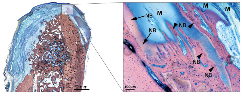 Bild Regedent OSSIX VOLUMAX Vorteile
